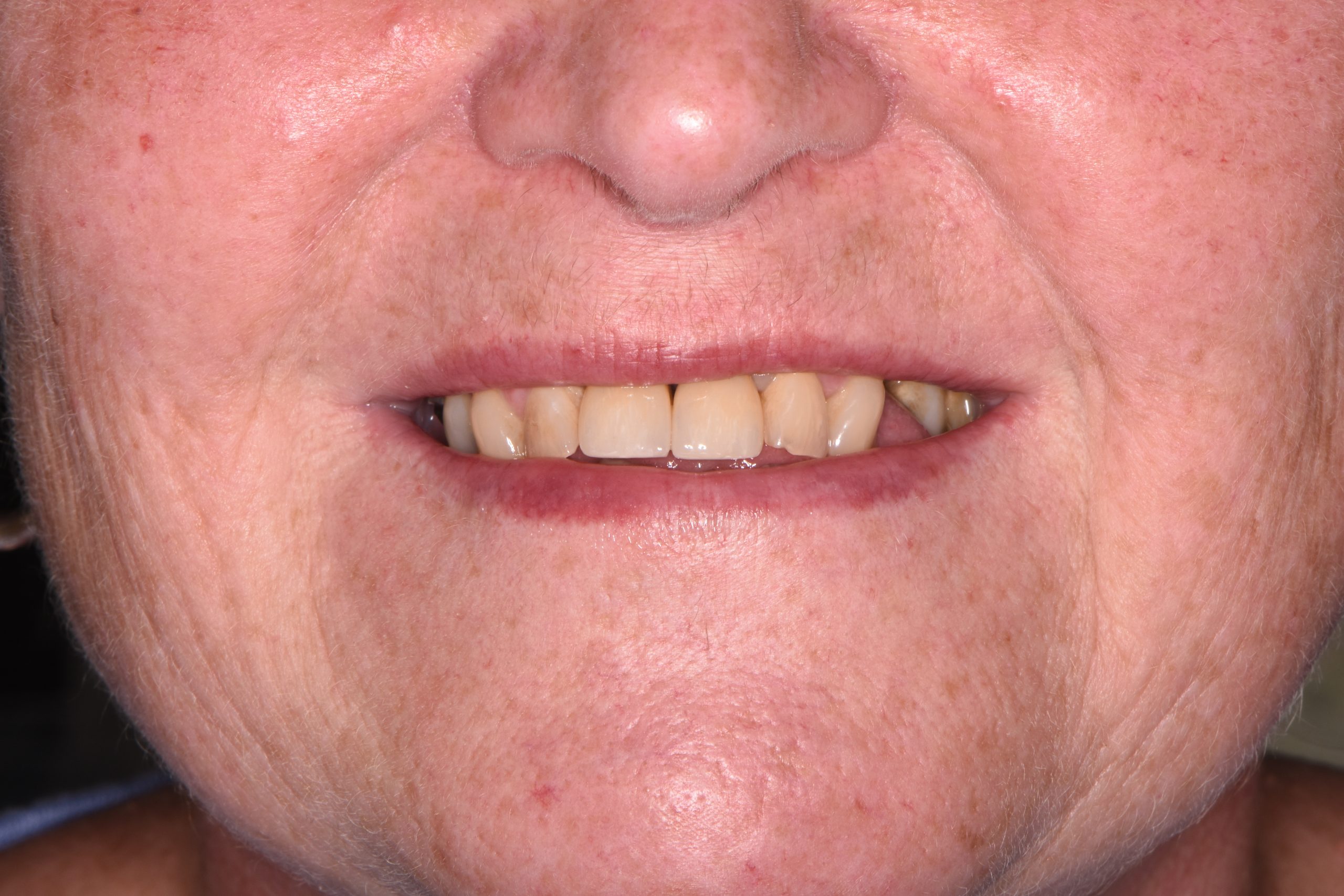 Sharon Jackson after