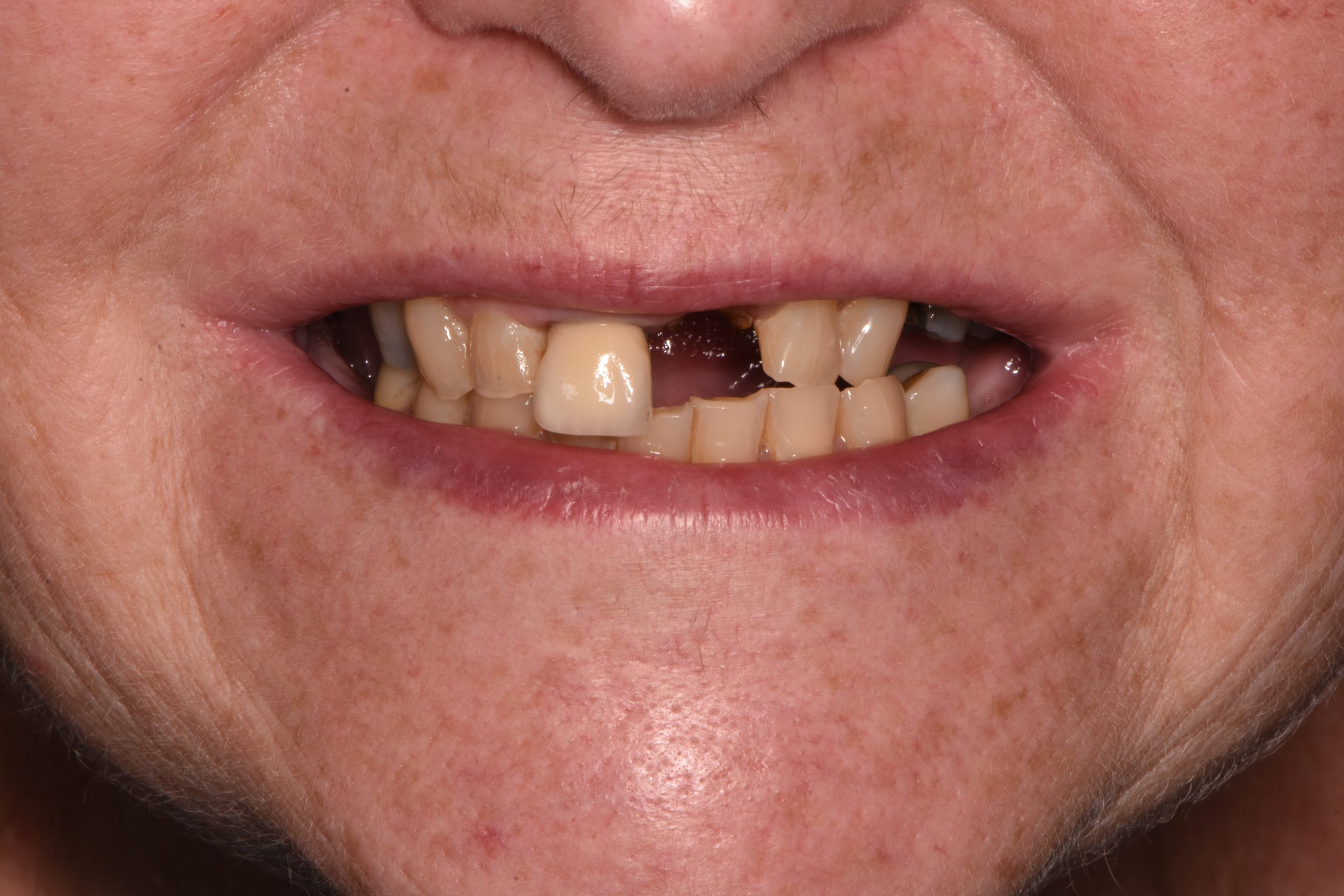 Sharon Jackson before