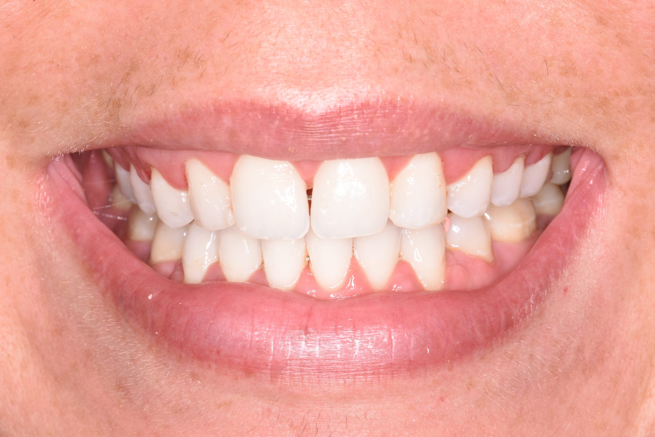 Siobhan Morgan before