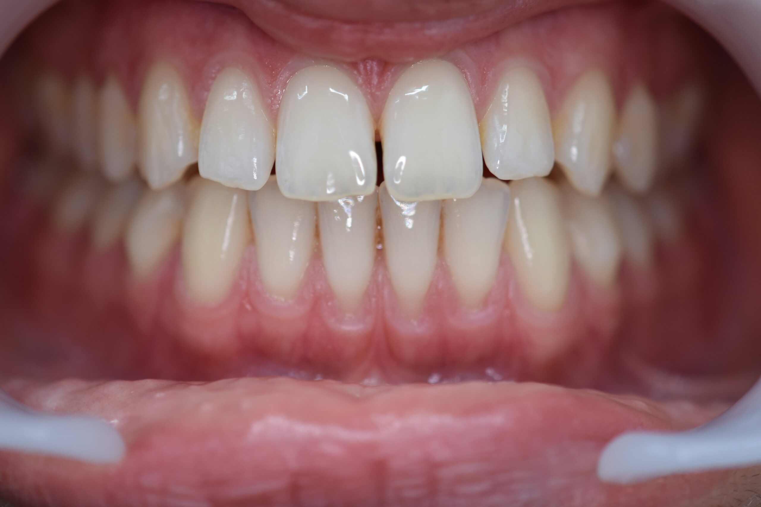 AZ before-min AZ before-min